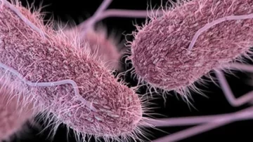 Salmonella Shigella