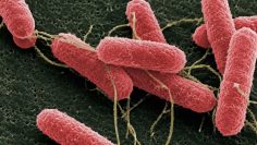 Escherichia coli